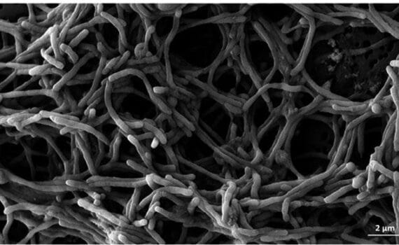 Tenacibaculosis