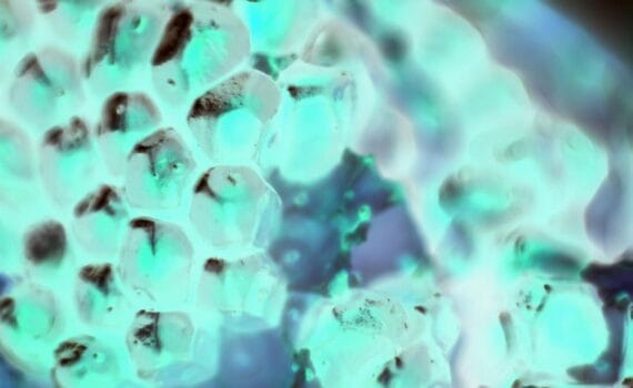 Identificación de nuevas cepas de Vibrio campbellii portadoras del plásmido pVA1, aisladas en postlarvas de Penaeus vannamei afectadas por brotes de necrosis hepatopancreática aguda (AHPND) en México